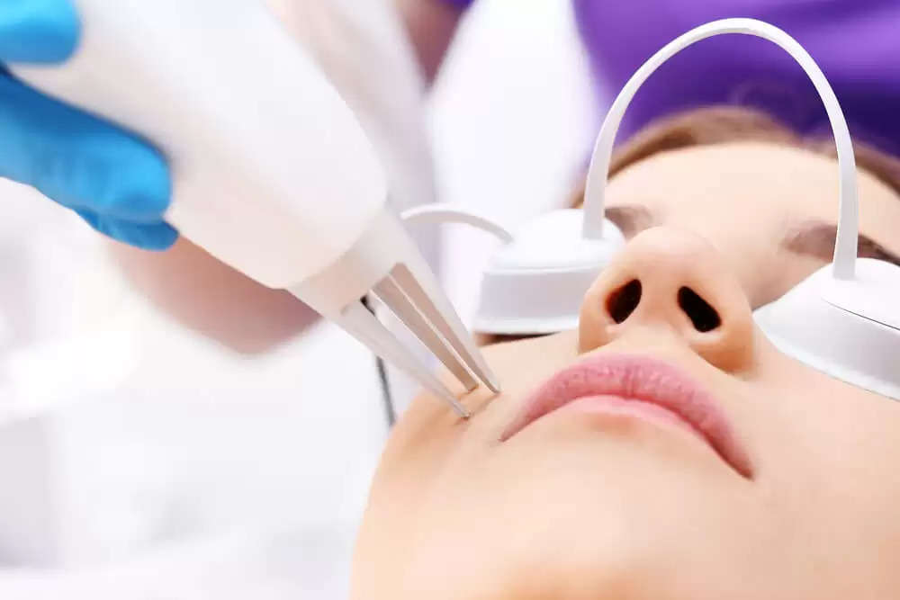 Laser Treatment For Facial Scars