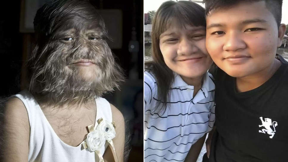 When The World's Hairiest Women Shaved Her Face After Finding Love