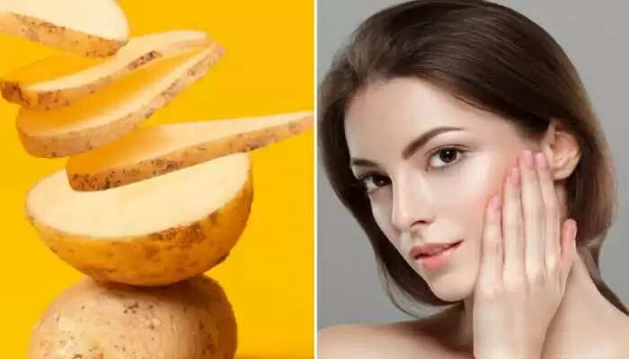 Top Potato Face Packs for Skin Brightening