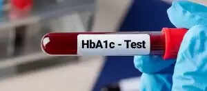 HbA1c Test - Understanding the Results