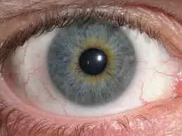 Reason Behind Death With Eyes Open