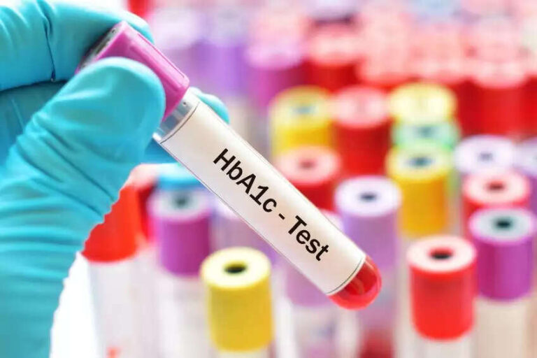 How Often Should You Get an HbA1c Test if You Have Diabetes?